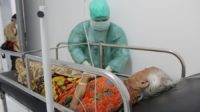 Pulang Umrah, Nenek Ini Diduga Idap Virus MERS