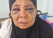 Tambang Ilegal Diduga Picu Pengeroyokan Nenek di Pasaman
